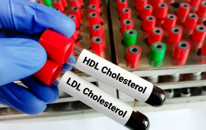 يخفض الكوليسترول بنسبة علاج جيني
